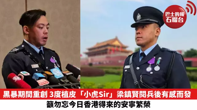 黑暴期間重創 3度植皮「小虎Sir」梁鎮賢閱兵後有感而發 籲勿忘今日香港得來的安寧繁榮